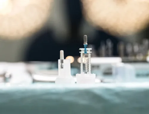 Qu’est-ce qu’un implant dentaire?
